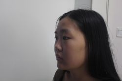 -成都西区医院整形美容