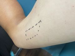 -海曼康复|HealmanClinic