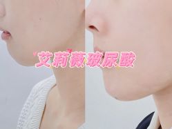 -温州伯思立医院