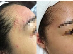 -康美贞·痘肌养护管理中心