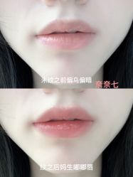 -OnFaer.纹眉半永久无创洗眉