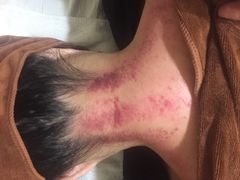 -沐善人家中医·推拿·理疗·三伏灸(新洲店)