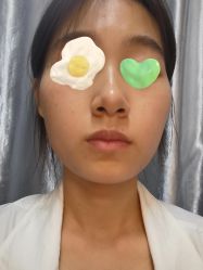 -成都西区医院整形美容