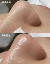 点击看大图 -栖SPA·ONDA ·海菲秀·皑皑科技美肤中心