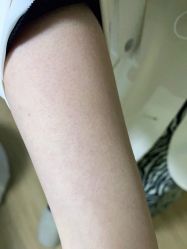 -Younger Skin·科技氧肤中心