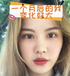 -素美医疗美容·西南眼鼻整形·修复基地