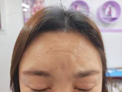 -洁铭新加坡医美