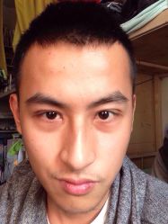 -哈尔滨瑞丽医疗美容医院