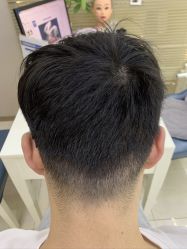 点击看大图 -大麦微针植发丨全国连锁