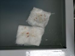 传世玉颜专业祛痘连锁机构(雁塔店)-传世玉颜专业祛痘·问题肌
