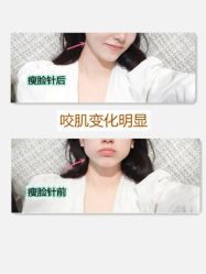 -长沙雅美医疗美容医院