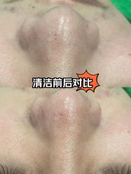 -黛颜人·清颜堂专业祛痘·皮肤管理