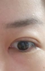 体验后-广州美莱医疗美容医院