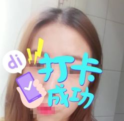 -大麦微针植发全国连锁