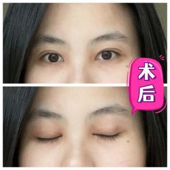 -素美医疗美容·西南眼鼻整形·修复基地