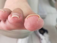 -新甲连锁灰指甲·甲沟炎·鸡眼(黑龙江路店)