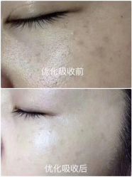 点击看大图 -优活悦妍美肤养生抗衰中心