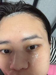 体验后-杭州奥拉克医疗美容门诊部