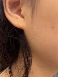 -美瑞莎创美医疗美容
