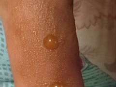 -大韩庄韩氏祖传正骨