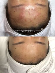 -Hi Beauty Skin 科技美肤中心