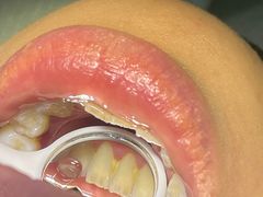 -土豆口腔(凤凰北总店)