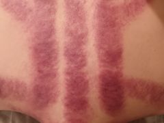 -左悦·艾灸调理·推拿按摩·精油SPA(卓悦汇店)