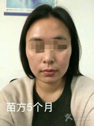 -苗方清颜专业祛痘