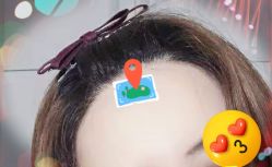 -大麦微针植发全国连锁