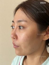 -北京米扬丽格医疗美容·联合丽格鼻整形中心