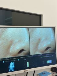-苑苑vbeauty科技美容SPA