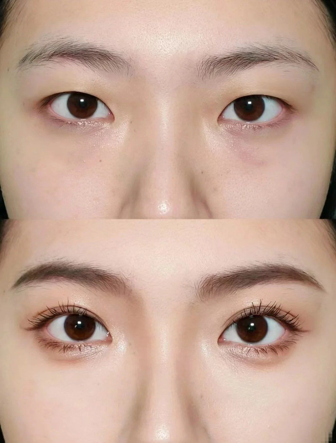 这篇分享给初眼的你们~
 
手术原因:一直羡慕别人的大眼睛双眼皮