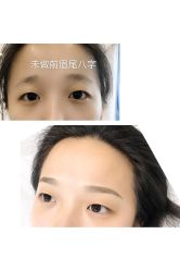 -MIVI半永久纹眉纹绣