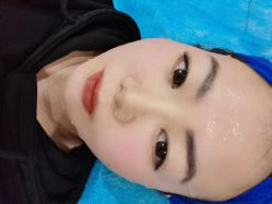体验后-鑫元辰医疗美容整形