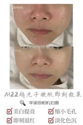 -E.beauty驻颜·痘敏肌调理中心