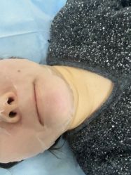 -长沙雅美医疗美容医院