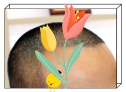 -大麦微针植发全国连锁