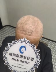 -唐风采假发补发定制