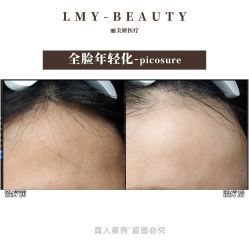 -丽美妍医疗美容·皮秒·立体分层抗衰