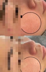 -SKIN79皮肤管理中心