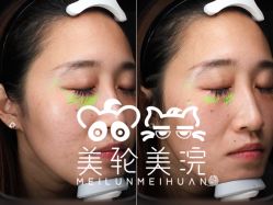 -海菲秀·飞顿牛奶光·LDM官方授权中心美轮美浣瓷感美肌