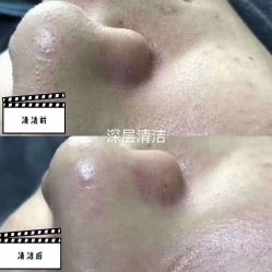 -Deeplus+韩国皮肤管理한국피부관리·C:Lab肌肤实验室