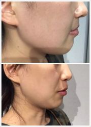 光SPA小V脸-光SPA科技美肤