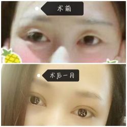 -四川米兰柏羽医学美容医院