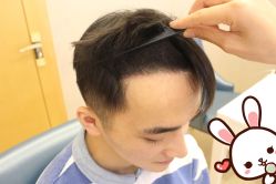 -大麦微针植发丨全国连锁