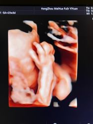 -杭州贝瑞斯美华妇儿医院·早孕·产检·儿科