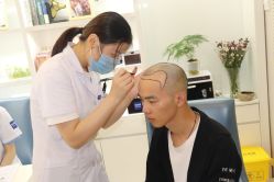 点击看大图 -大麦微针植发丨全国连锁