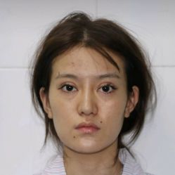 点击看大图 体验前-烟台曙光医疗美容医院