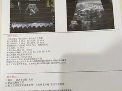 -济南艾玛体检中心