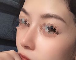 -成都西区医院整形美容